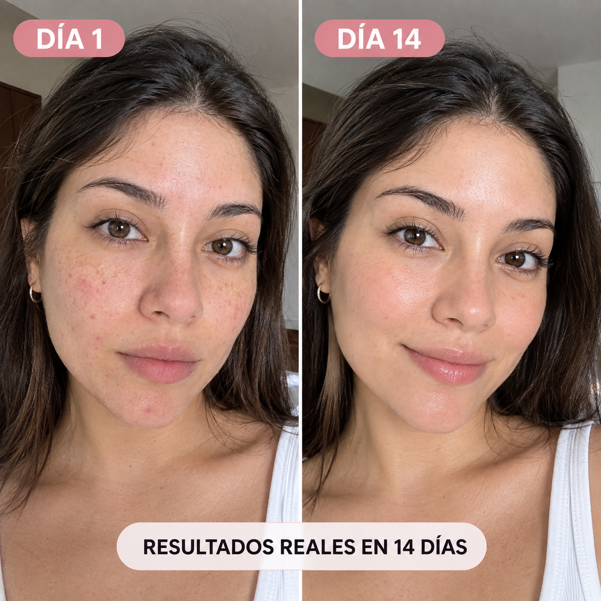 Lumitech Pro - Mascarilla Facial LED
